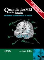 Télécharger cet ebook : Quantitative MRI of the Brain: Measuring Changes Caused by Disease 