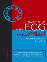 Télécharger cet ebook : Making Sense of the ECG: Cases for Self-Assessment