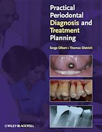 Télécharger cet ebook : Practical Periodontal Diagnosis and Treatment Planning