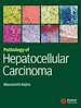 Téléchargez le livre numérique:  Pathology of Hepatocellular Carcinoma