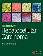 Téléchargez le livre numérique:  Pathology of Hepatocellular Carcinoma
