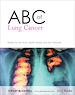 Téléchargez le livre numérique:  ABC of Lung Cancer