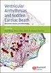Téléchargez le livre numérique:  Ventricular Arrhythmias and Sudden Cardiac Death