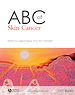 Téléchargez le livre numérique:  ABC of Skin Cancer