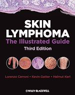 Télécharger cet ebook : Skin Lymphoma