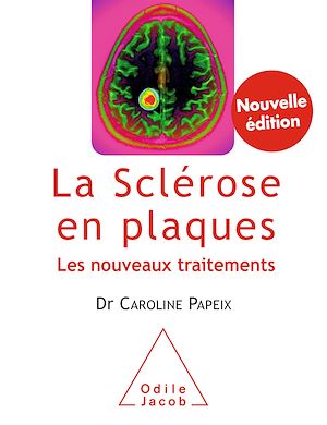 LA SCLEROSE EN PLAQUES - LES NOUVEAUX TRAITEMENTS -NED