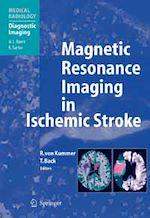 Télécharger le livre :  Magnetic Resonance Imaging in Ischemic Stroke