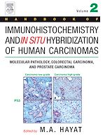 Télécharger le livre :  Handbook of Immunohistochemistry and in Situ Hybridization of Human Carcinomas