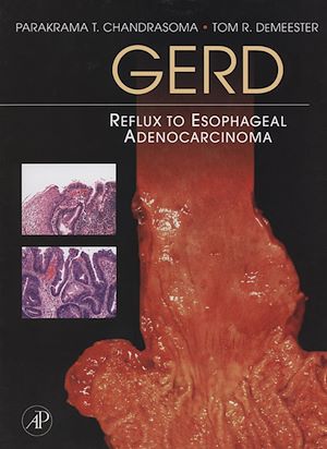 Téléchargez le livre :  GERD