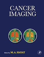 Télécharger le livre :  Cancer Imaging