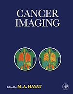 Télécharger le livre :  Cancer Imaging
