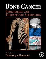 Télécharger le livre :  Bone Cancer