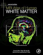 Télécharger le livre :  MRI Atlas of Human White Matter