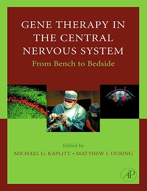 Téléchargez le livre :  Gene Therapy of the Central Nervous System: From Bench to Bedside