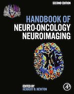 Télécharger le livre :  Handbook of Neuro-Oncology Neuroimaging