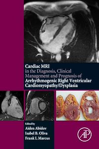 Téléchargez le livre :  Cardiac MRI in Diagnosis, Clinical Management, and Prognosis of Arrhythmogenic Right Ventricular Cardiomyopathy/Dysplasia