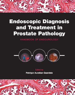 Téléchargez le livre :  Endoscopic Diagnosis and Treatment in Prostate Pathology