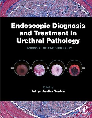 Téléchargez le livre :  Endoscopic Diagnosis and Treatment in Urethral Pathology