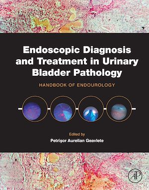 Téléchargez le livre :  Endoscopic Diagnosis and Treatment in Urinary Bladder Pathology