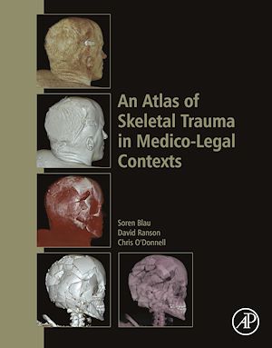 Téléchargez le livre :  An Atlas of Skeletal Trauma in Medico-Legal Contexts