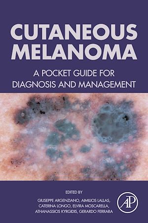 Téléchargez le livre :  Cutaneous Melanoma