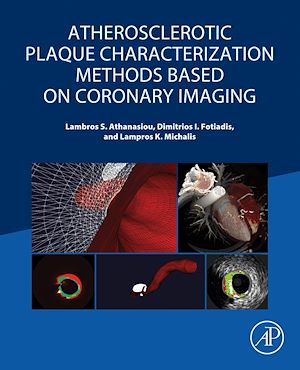 Téléchargez le livre :  Atherosclerotic Plaque Characterization Methods Based on Coronary Imaging