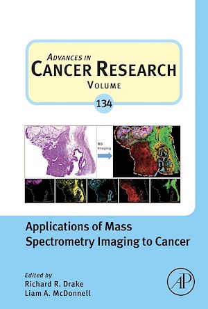 Téléchargez le livre :  Applications of Mass Spectrometry Imaging to Cancer