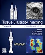 Télécharger le livre :  Tissue Elasticity Imaging