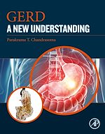 Download this eBook GERD
