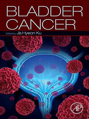 Téléchargez le livre :  Bladder Cancer