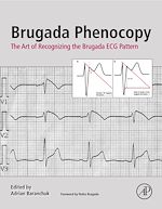 Télécharger le livre :  Brugada Phenocopy