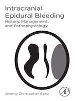 Télécharger le livre :  Intracranial Epidural Bleeding
