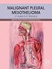 Télécharger le livre :  Malignant Pleural Mesothelioma