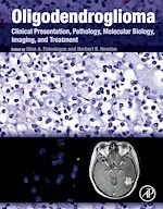 Télécharger le livre :  Oligodendroglioma