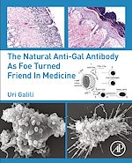 Télécharger le livre :  The Natural Anti-Gal Antibody as Foe Turned Friend in Medicine