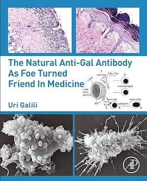 Téléchargez le livre :  The Natural Anti-Gal Antibody as Foe Turned Friend in Medicine