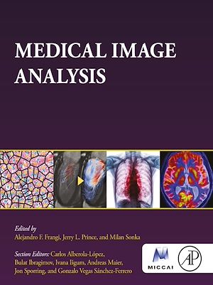 Download the eBook: Medical Image Analysis