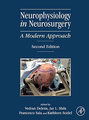 Téléchargez le livre :  Neurophysiology in Neurosurgery