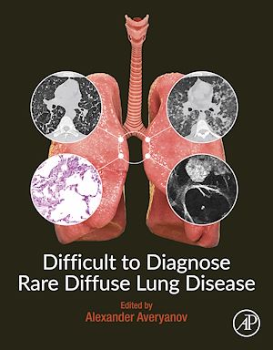 Téléchargez le livre :  Difficult to Diagnose Rare Diffuse Lung Disease