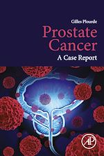 Télécharger le livre :  Prostate Cancer