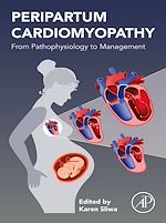 Télécharger le livre :  Peripartum Cardiomyopathy