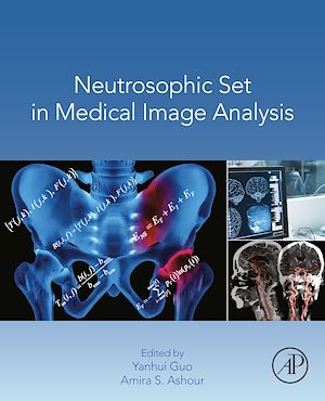 Téléchargez le livre :  Neutrosophic Set in Medical Image Analysis
