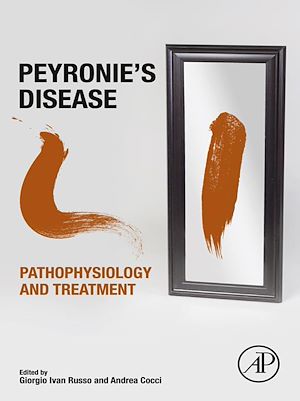 Téléchargez le livre :  Peyronie's Disease: Pathophysiology and Treatment