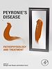 Télécharger le livre :  Peyronie's Disease: Pathophysiology and Treatment