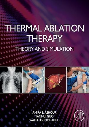 Téléchargez le livre :  Thermal Ablation Therapy