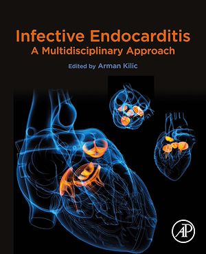 Download the eBook: Infective Endocarditis