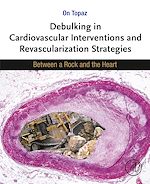 Télécharger le livre :  Debulking in Cardiovascular Interventions and Revascularization Strategies