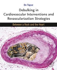 Téléchargez le livre :  Debulking in Cardiovascular Interventions and Revascularization Strategies