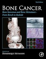 Télécharger le livre :  Bone Cancer
