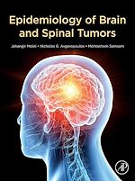 Télécharger le livre :  Epidemiology of Brain and Spinal Tumors